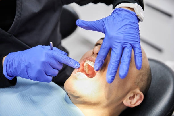 Best Emergency Dental Care for Sports Injuries in Dade City, FL
